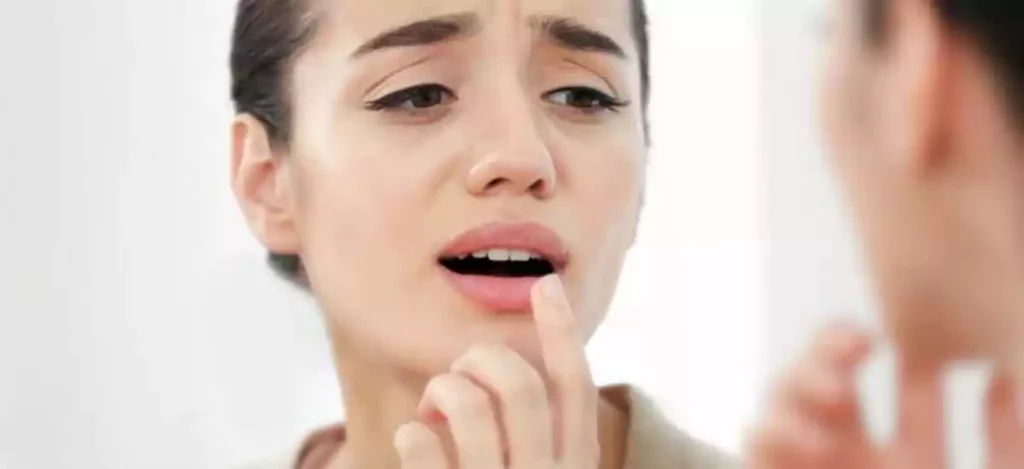 how to cure dry lips