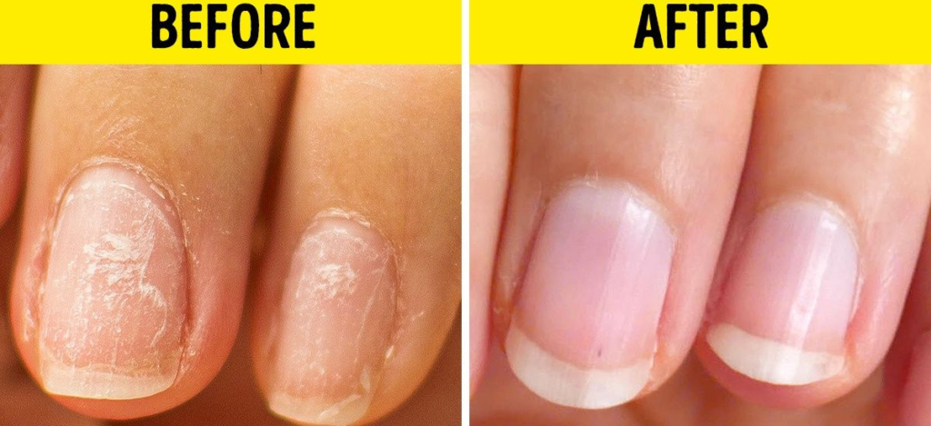 Get Strong and Beautiful Nails at Home- Simple Home Remedies