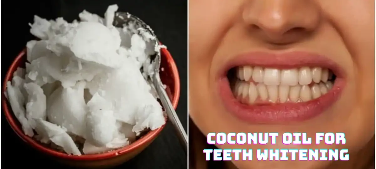 Coconut Oil For Teeth Whitening